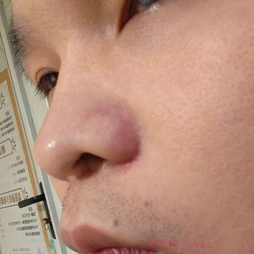 30岁岁江苏单身帅哥 - 淮安吉缘网